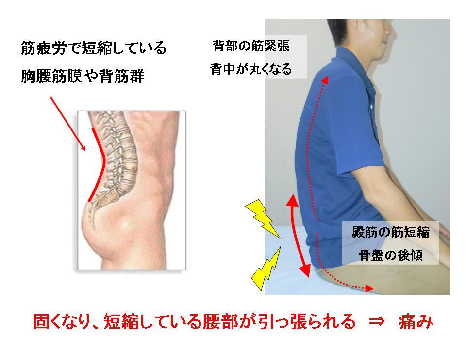 膿筋解放と深部組織マッサージツールPsoas、背中、股関節屈筋リリースツール 膿筋解放と深部組織マッサージツールPsoas、背中、股関節屈筋リリース ツール